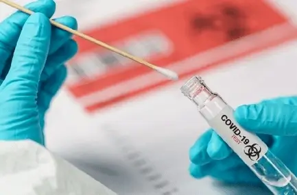 lima covid antigen test